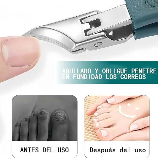 ✂️ CortaUñas Pro – Cortauñas de Precisión para Uñas Gruesas