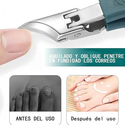 ✂️ CortaUñas Pro – Cortauñas de Precisión para Uñas Gruesas